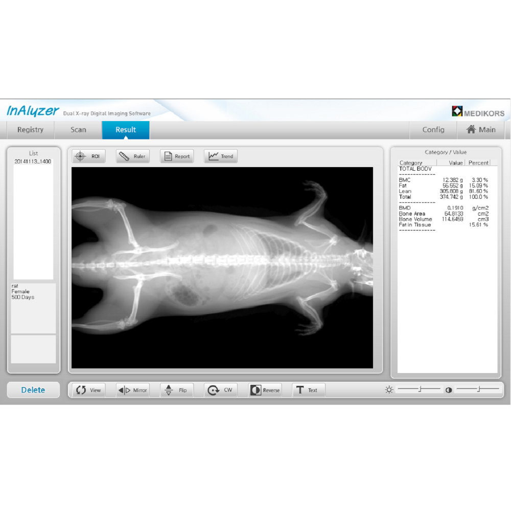 INALYZER
