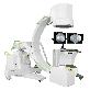 detail image3 Surgical C-arm X-ray System