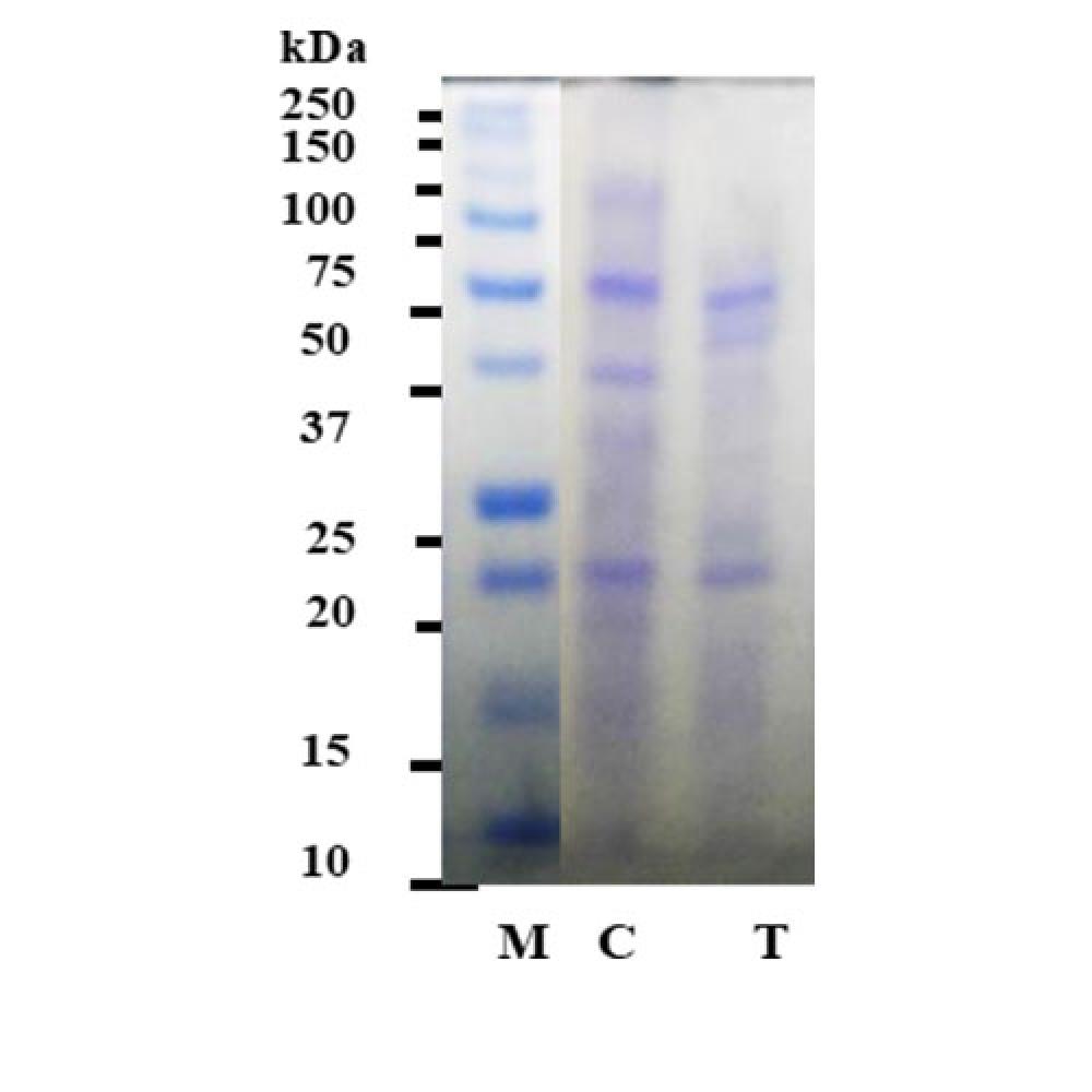 Antibacterial Peptide Microbial(P/WS : Water Soluble)